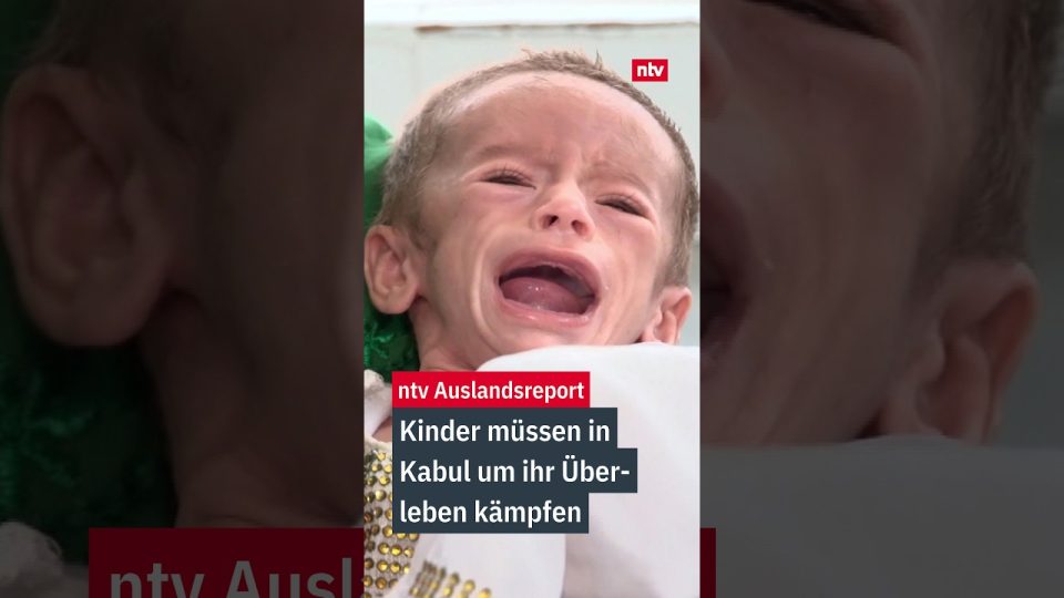Unterernährtes Baby in einem Krankenhausbett in Kabul – Kinder in Kabul kämpfen ums Überleben